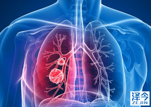 特罗凯和易瑞沙治疗优势分析