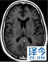 史上最全！肺癌靶点全面解读及对应靶向药物方案盘点！（2018）