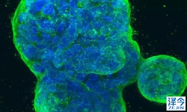 乳腺癌患者新希望！针对HER2蛋白的乳腺癌疫苗VRP-HER2横空出世！