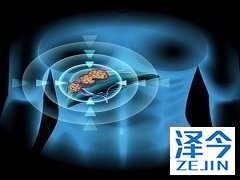 乐伐替尼对难治性甲状腺乳头状癌的影响