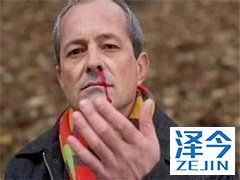 一例未知原发性鳞状细胞癌对多乐伐替尼的反应