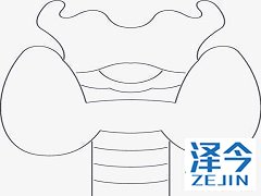 乐伐替尼会引起高血压吗？