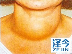 乐伐替尼联合依维莫司增强抗肿瘤活性的基础