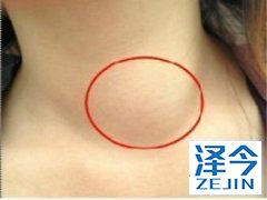 乐伐替尼是一种有前途的多种癌症分子靶向药物