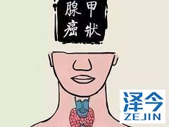 乐伐替尼治疗患者常见副作用的发生率