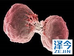 乐伐替尼能够治疗甲状腺癌吗