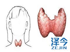 乐伐替尼在甲状腺癌中的最佳应用