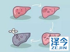 乐伐替尼作为一线用药具有更大的生存期优势。