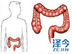 结肠癌病情进展患者可以使用PD-1吗?