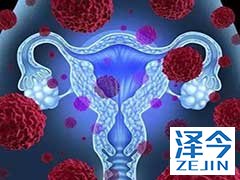 尼拉帕尼为什么可以治疗卵巢癌？