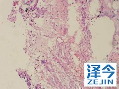 为什么更多人选择帕博西尼