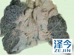 曲妥珠单抗克服奥希替尼的耐药性