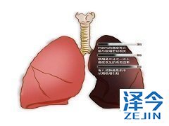 奥希替尼对生物标志物表达的调节