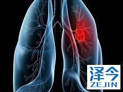 FDA批准奥希替尼一线治疗EGFR+和NSCLC
