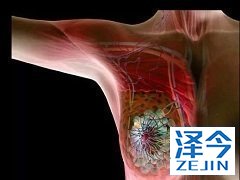 来那替尼能够改善患者的预后情况