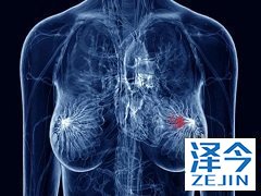 仅使用来那替尼治疗乳腺癌可以吗