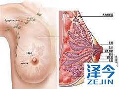 来那替尼对于早期HER2过表达患者的治疗