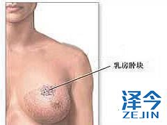 在曲妥珠单抗治疗后使用来那替尼的治疗最有效 