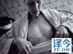 这两种乳腺癌患者使用来那替尼治疗效果更好