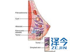 来那替尼的推荐使用剂量是多少