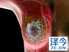 来那替尼首次延长辅助治疗用于HER2阳性乳腺癌
