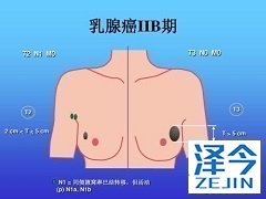 来那替尼的有效性已被证实