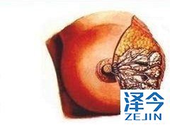 来那替尼在使用中有哪些需要注意的方面