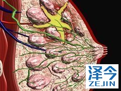 来那替尼用于抗转移性乳腺癌