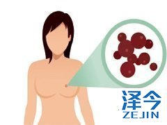 为什么推荐成年人患者使用来那替尼？