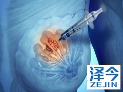 复发阳性乳腺癌患者使用来那替尼治疗可以吗？