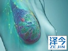 T-DM1联用来那替尼可增加乳腺癌缓解率