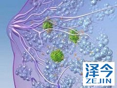 来那替尼作用赫赛汀的强化辅助药物效果如何？