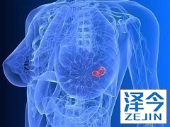 治疗乳腺癌每天应该吃几片来那替尼 