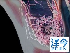 来那替尼效果怎么样