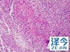 苏金单抗是一种生物制剂 