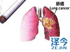 布加替尼与阿来替尼哪个效果好 