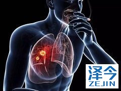 患者服用布加替尼(BRIGETIN)出现肺部不适怎么办