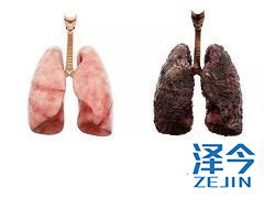 布加替尼对T790M双突变非小细胞肺癌也有一定的疗效