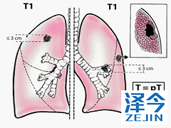 布加替尼治疗剂量可递增使用