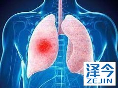 布加替尼是ALK抑制剂中效果最好的药物吗