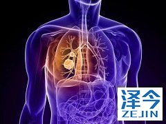 布加替尼治疗晚期非小细胞肺癌