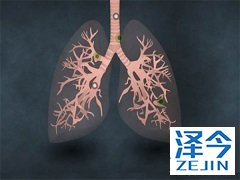 布加替尼与克唑替尼的效果对比