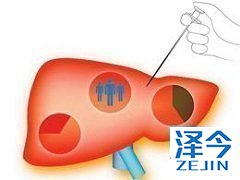 患者服用TAF时还要注意生活习惯！