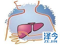 TAF具有的优点能否与它的价格成对等?