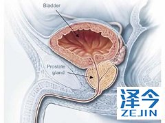 阿比特龙是一种什么药？