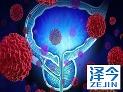 阿比特龙是前列腺癌患者的首选药物！