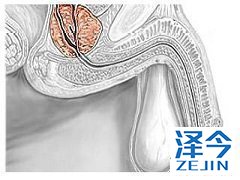 阿比特龙治疗前列腺癌前为何要做心脏健康检查？