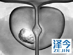 阿比特龙有哪些副作用？