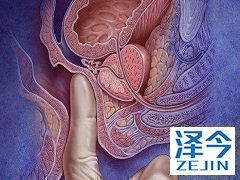 还有其他版本的阿比特龙治疗患者吗？