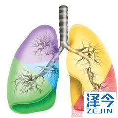 尼达尼布的注意事项有哪些?